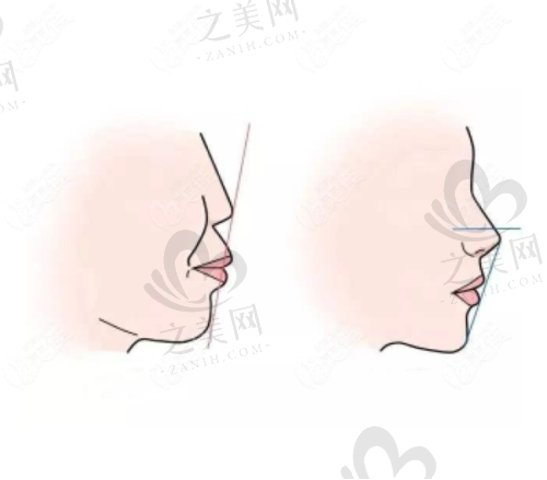 种牙与矫正项目详情