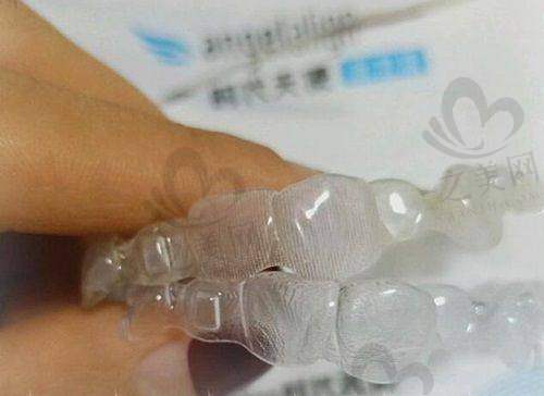 综合评估是否值得去