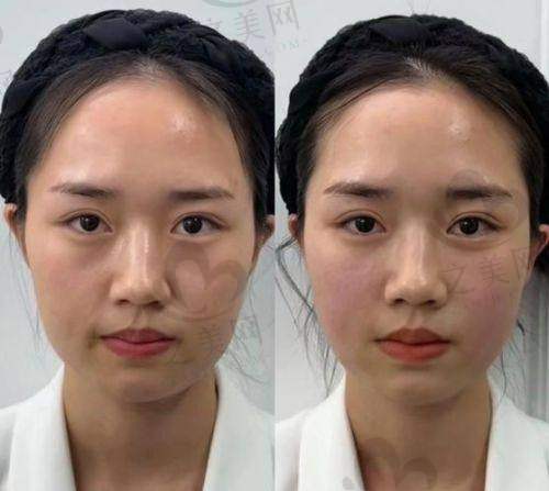 超玛吉FLX的规格与功效多样