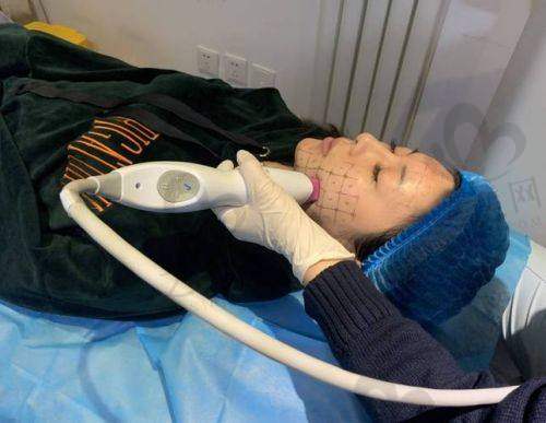 杭州禾慕时光医疗美容半岛5代黄金微针5888元起,八大功效抗衰,助你实现肌肤美丽蜕变!