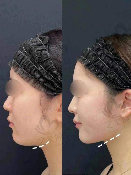 医生团队：专精技术保驾护航