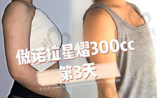 强大医生团队，技术不错可靠