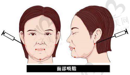 专精医生保驾护航