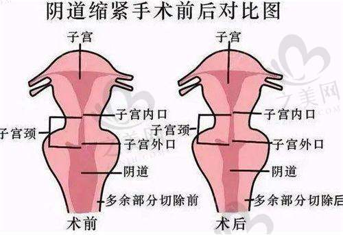适用范围广且可定制