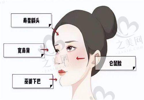 与传统技术对比更胜一筹