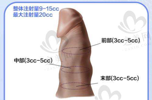 抓住机会——开启美丽之旅