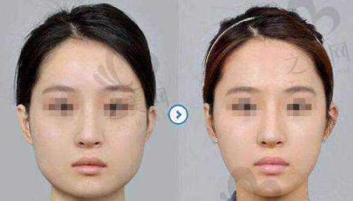 热门项目丰富,多维度塑美