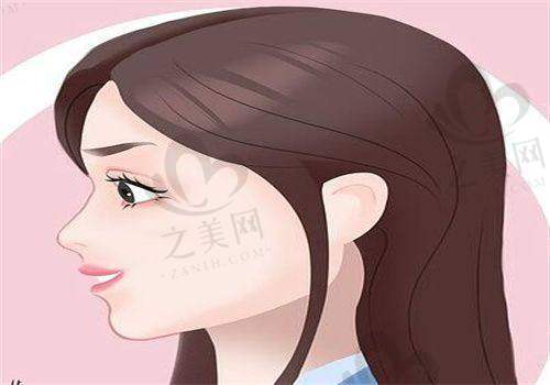 项目适应人群广泛