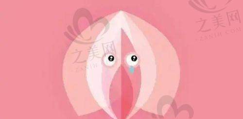 强生鱼骨线优势多