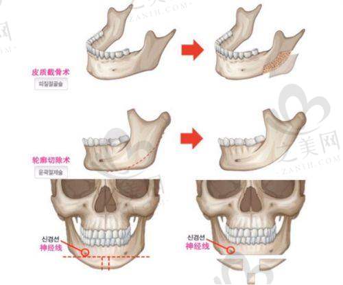 花苞精細(xì)化雕刻項(xiàng)目適合人群廣泛