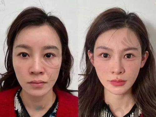 铂金三文鱼项目实惠