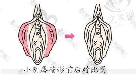广州建国医院实例