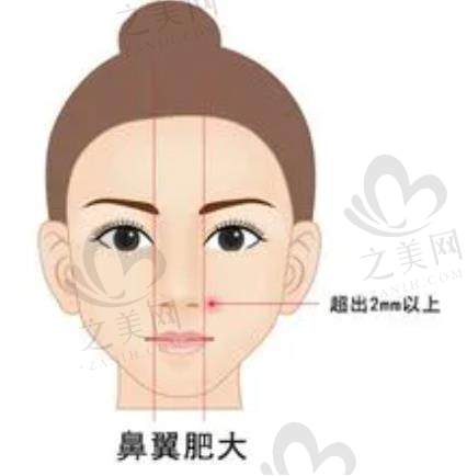 厦门思明荟美天成整形医院实力出圈!酒窝单侧6000元起,多项目价格优效果好