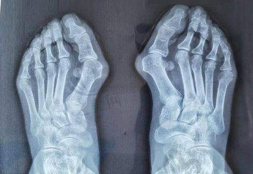 硅胶下巴性价比高