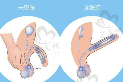 与其他医院对比优势明显