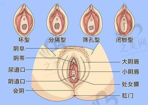 丰富的填充材料选择
