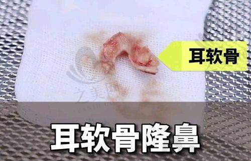 专精医生团队护航