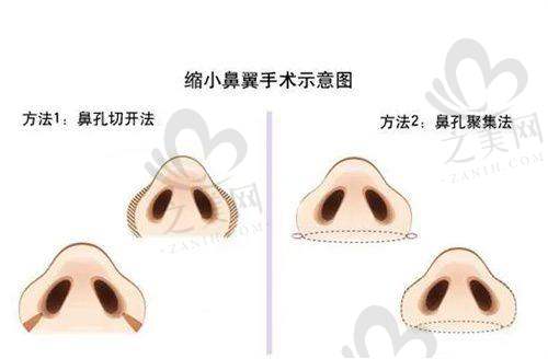 其他热门项目丰富多样