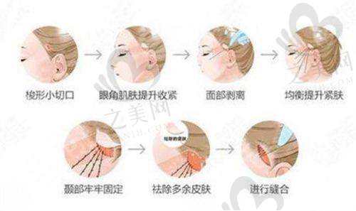 私密整形项目与价格