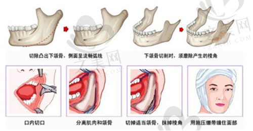 抗衰老项目针对性强