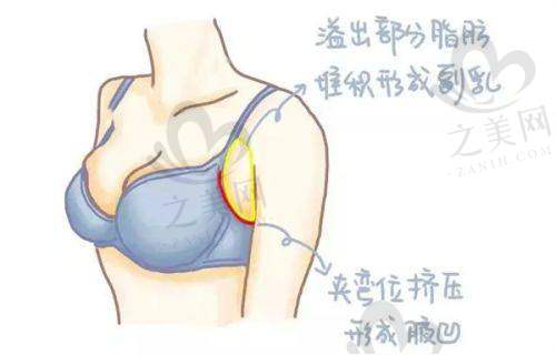 优惠活动吸引人