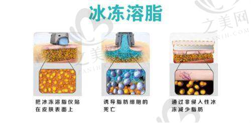 私密清洁呵护健康
