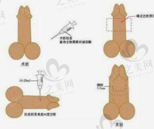 个性化方案精细定制