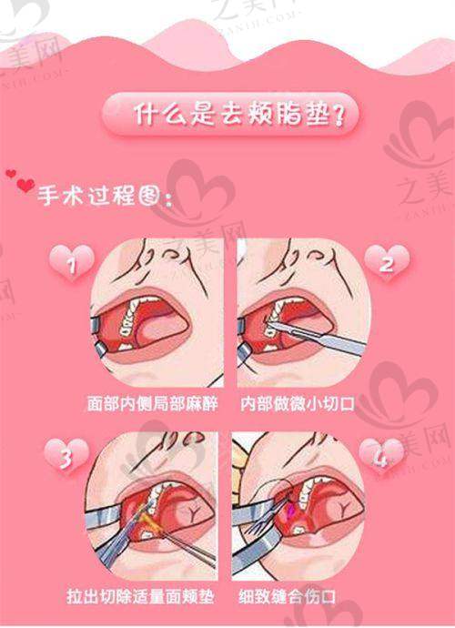 专精医生团队，注射更放心