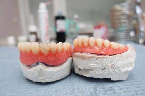 深圳富华口腔医院牙齿矫正优势
