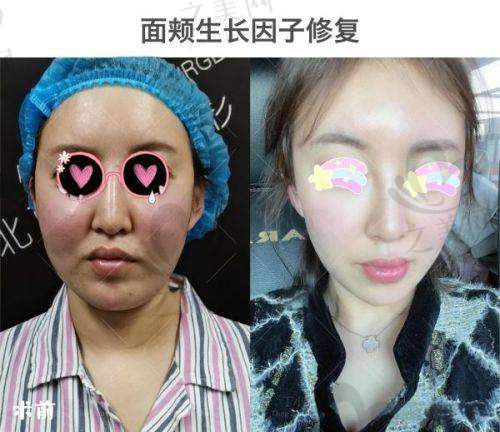 其他男科整形优质医院