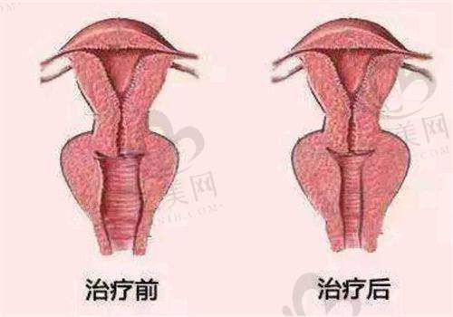 整形美容类医院的手术情况