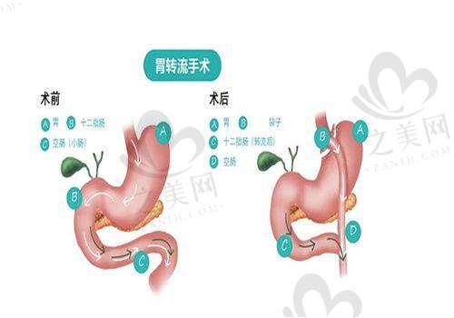 王圣博医生:多项目眼修复能手