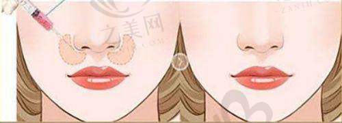 成都艺星韩春医生专注胸部整形