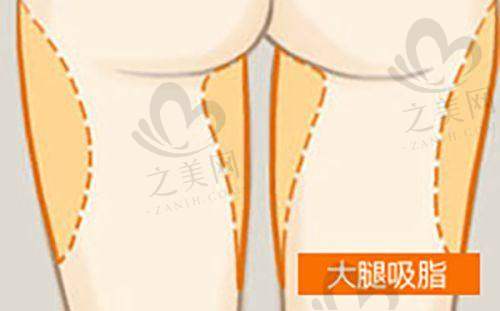 手术费用情况