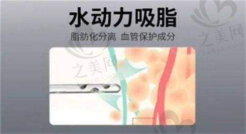 北京男科生殖延长手术费用范围