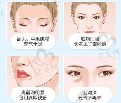 长沙综合排名靠前的男性增粗医院