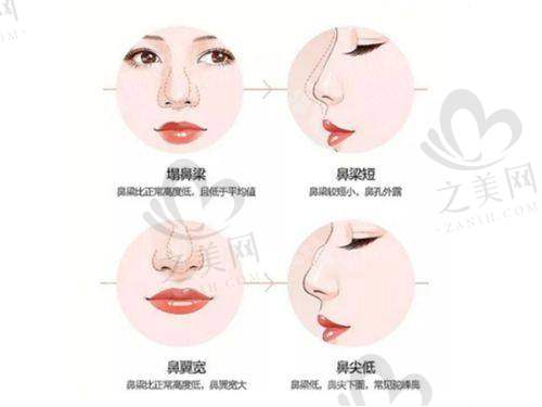 天津医院整形外科：国有三等甲吸脂保护