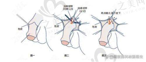 选择医院需综合考量
