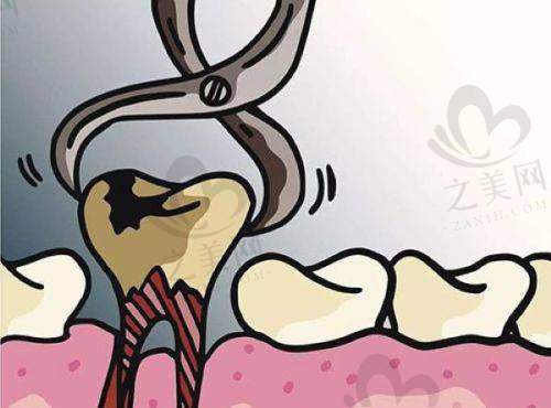 真实的港人患者种牙实录