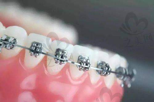 特色项目之美学正畸