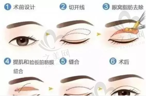 汉中韩美整形医院:口碑良好的水光针专科医院
