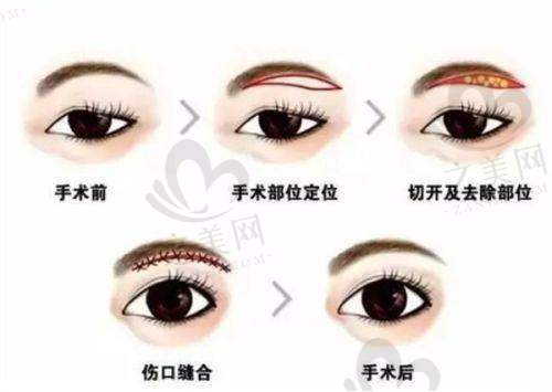 激光相关项目价格参考