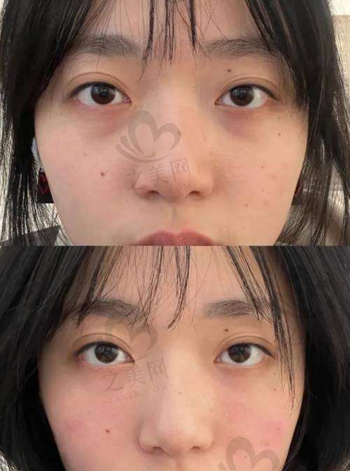 三种填充方案对比