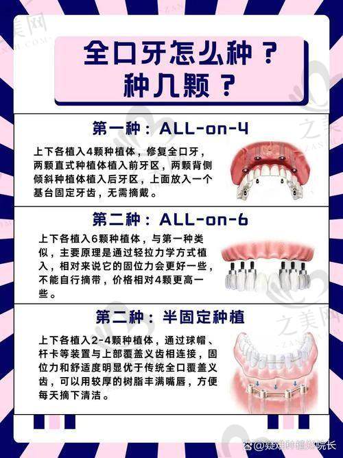 特色项目优势明显