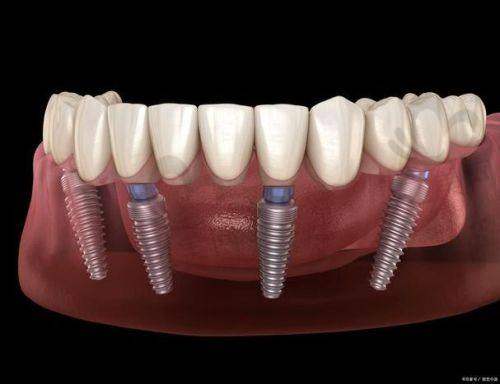 术后成效与注意事项