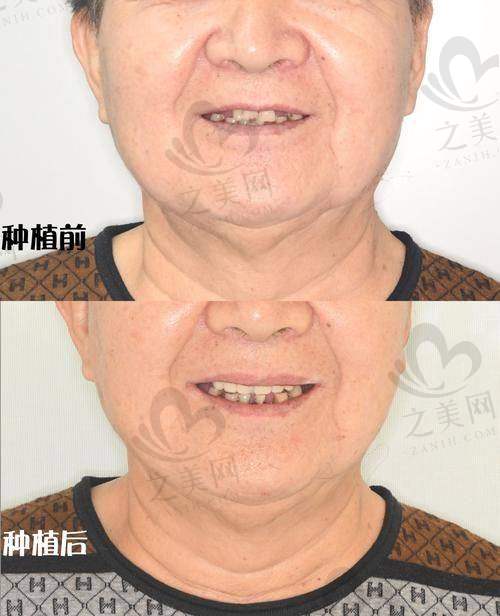 南阳百乐口腔收费价格