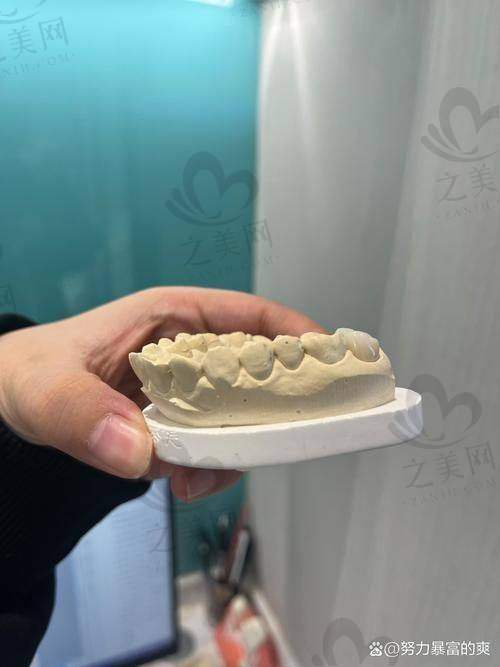 南阳方城万超口腔诊所收费价格