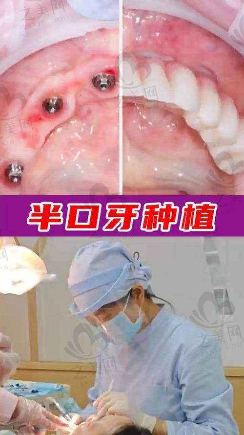 南阳康泽口腔诊所整牙费用
