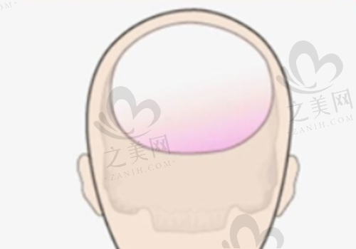 免费询问活动:了解手术更清晰