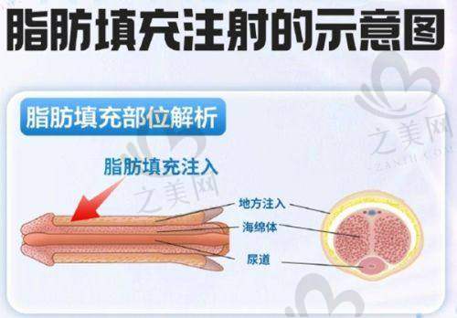 武汉亚韩：资质保护磨骨安心